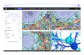 The Webknossos UI showcasing a volume EM dataset.